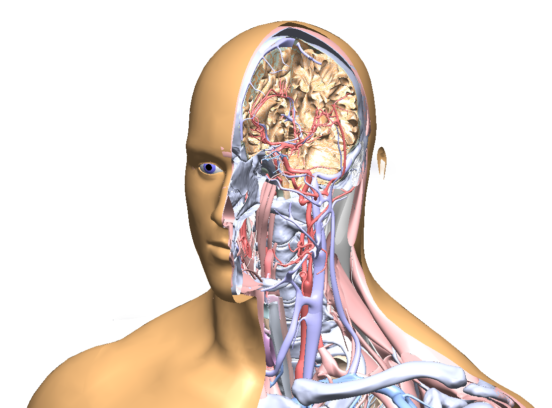 brain scan